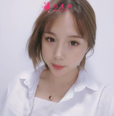 秦皇岛市中医院医学美容科自体脂肪全脸填充案例一览!含全新价格表展示