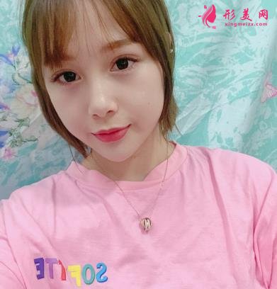 秦皇岛市中医院医学美容科自体脂肪全脸填充案例一览!含全新价格表展示