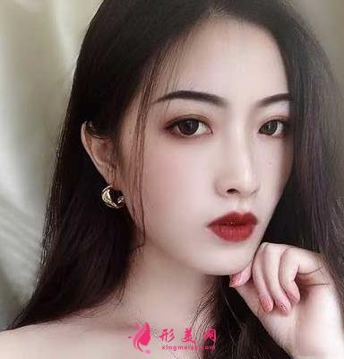 重医附二院整形科怎么样?快来参考埋线双眼皮案例及价格价目表