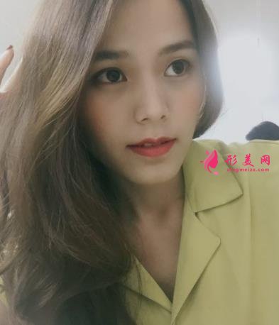 福州海峡美容医院去眼袋怎么样?技术特色、案例、价格收费双双公开