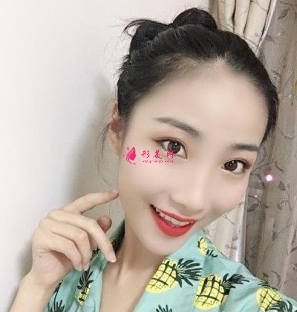 贵州省人民医院瘦脸针价格公示,医美老司机吐血分享,全是干货