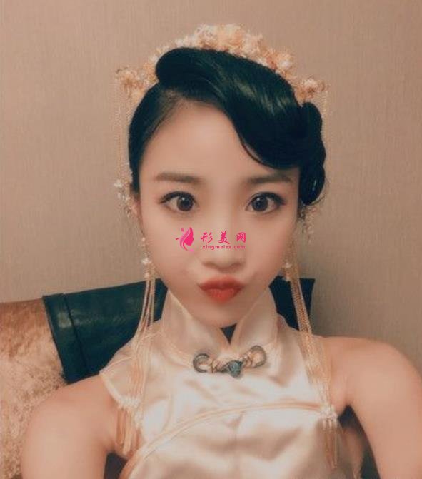 贵州省人民医院瘦脸针价格公示,医美老司机吐血分享,全是干货