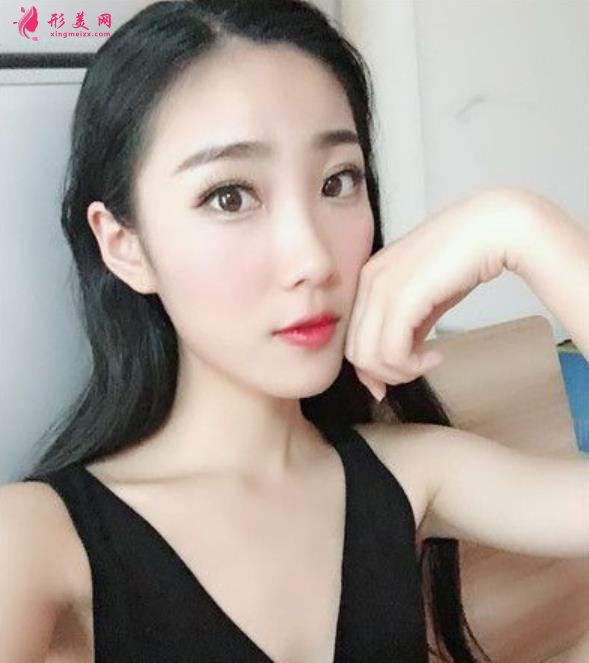 贵州省人民医院瘦脸针价格公示,医美老司机吐血分享,全是干货