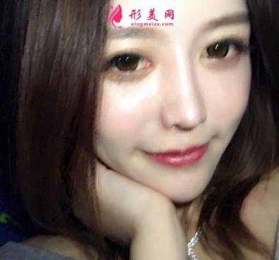 郑大一附院整形科做鼻子怎么样?医生案例及价格价目表公开反馈