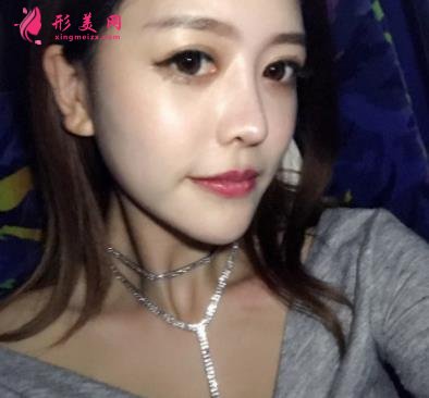 郑大一附院整形科做鼻子怎么样?医生案例及价格价目表公开反馈