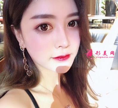 郑大一附院整形科做鼻子怎么样?医生案例及价格价目表公开反馈