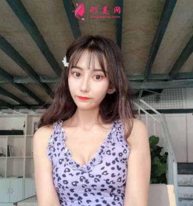 广州广大整形医院面部轮廓价格价目表公开!含实拍案例图分享!