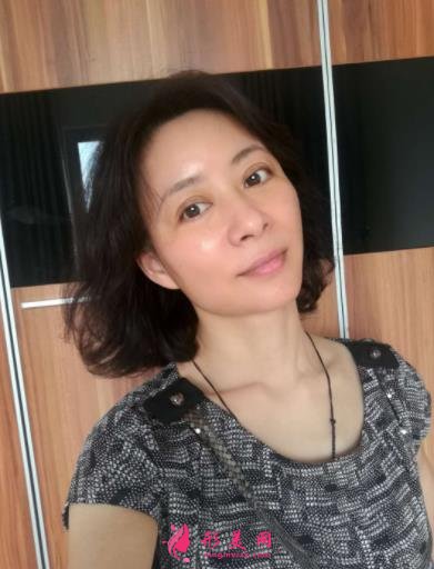 北京瑞丽冯立哲多维拉面部提升怎么样?案例及效果图公开查询