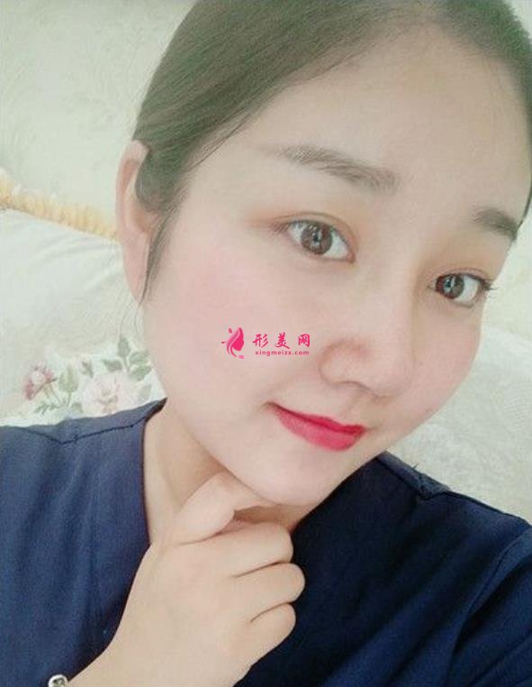 滁州鼓楼医院鼻综合怎么样?术后效果隆鼻的整形医生笑哭了!