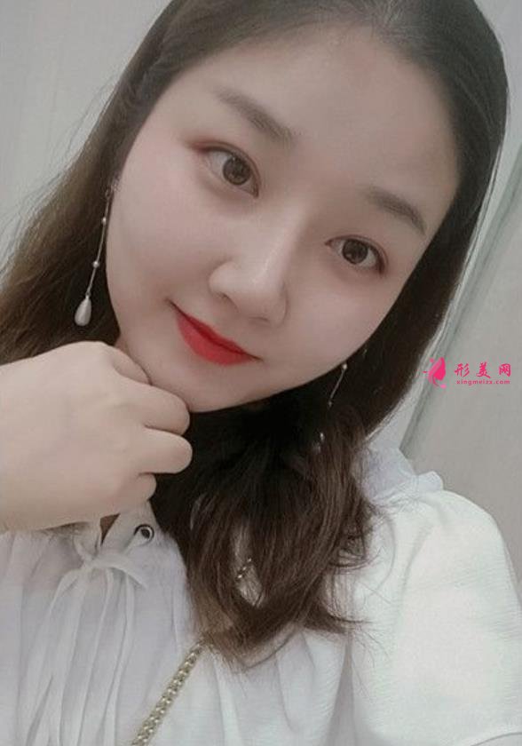 滁州鼓楼医院鼻综合怎么样?术后效果隆鼻的整形医生笑哭了!