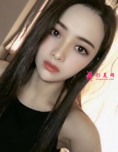 宁波壹加壹整形医院怎么样?从简介及激光去眼袋案例、价格收费可以看出