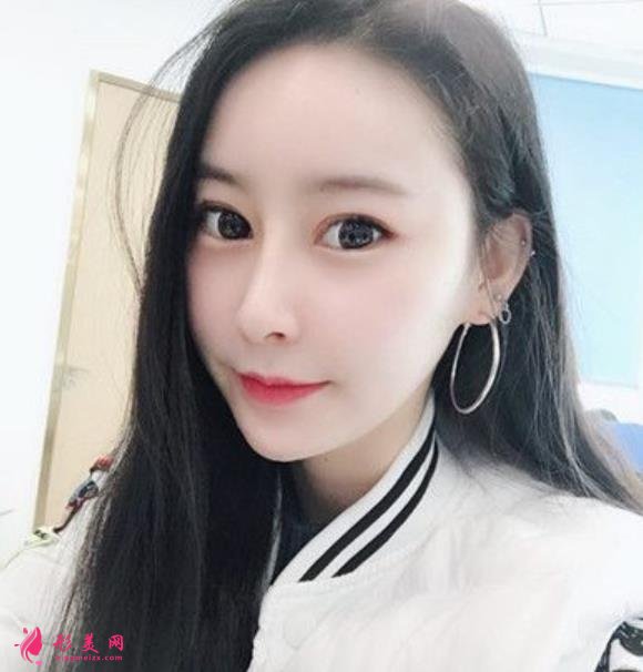 康华医院鼻综合多少钱?花五万做隆鼻!整形医生笑哭了