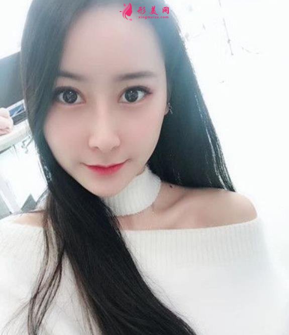 康华医院鼻综合多少钱?花五万做隆鼻!整形医生笑哭了