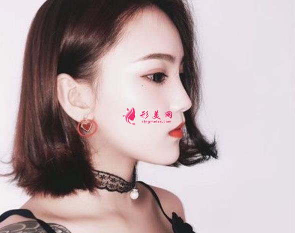 瑞丽整形医院鼻综合怎么样?上海小姐姐分享不一样的隆鼻子