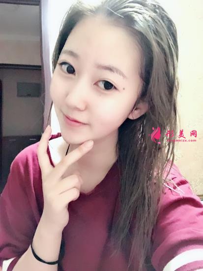 濮阳市人民医院整形科价格价目表收费公开!隆鼻案例对比反馈~