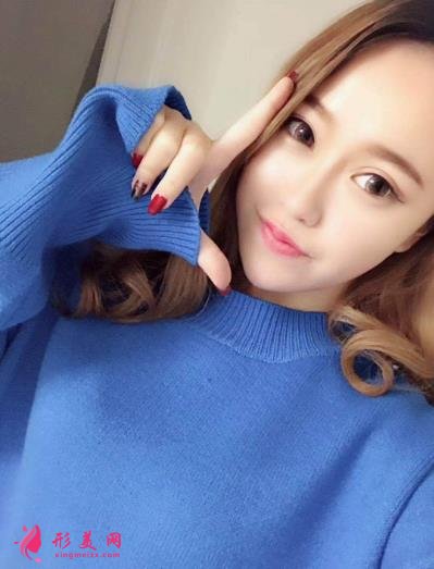 徐州医院双眼皮做得好吗?案例效果分享_眼部修复干货盘点