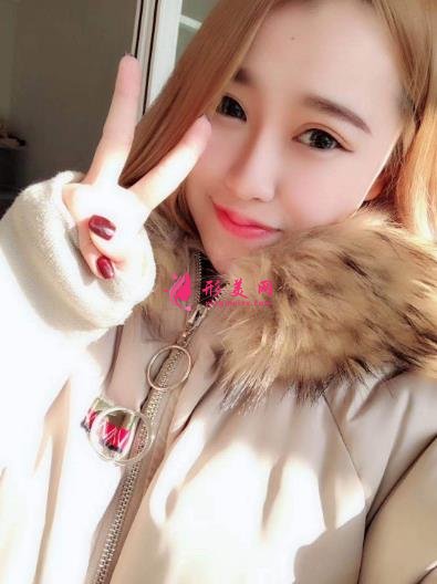 徐州医院双眼皮做得好吗?案例效果分享_眼部修复干货盘点