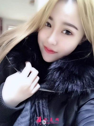 徐州医院双眼皮做得好吗?案例效果分享_眼部修复干货盘点