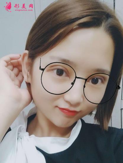 青岛市立医院双眼皮手术怎么样?附手术后注意事项盘点