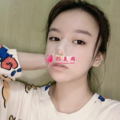 苏州昆山百达丽医疗美容靠谱吗?做鼻子真实案例及价目表_口碑介绍