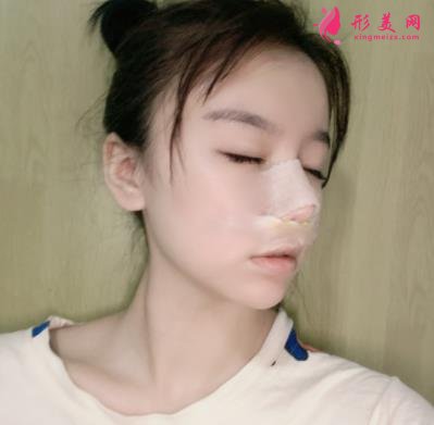 苏州昆山百达丽医疗美容靠谱吗?做鼻子真实案例及价目表_口碑介绍