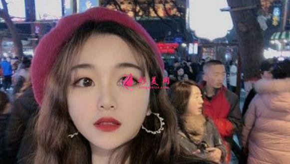 大连医大二院双眼皮怎么样?切开双眼皮手术前后效果对比