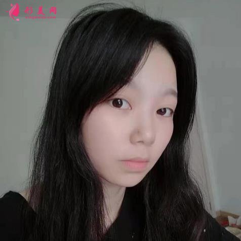 上海九院下颌角磨骨怎么样?特色技术分析和案例效果图汇总!你评评效果如何