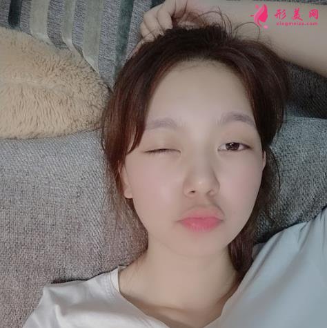 上海九院下颌角磨骨怎么样?特色技术分析和案例效果图汇总!你评评效果如何