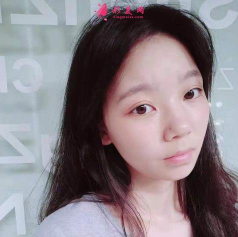 上海九院下颌角磨骨怎么样?特色技术分析和案例效果图汇总!你评评效果如何