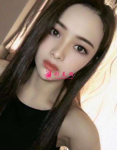 宁波壹加壹整形医院怎么样?从简介及激光去眼袋案例、价格收费可以看出