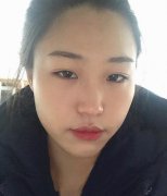淮安市第一人民医院整形科怎么样?瘦脸针案例+价格价目表分享
