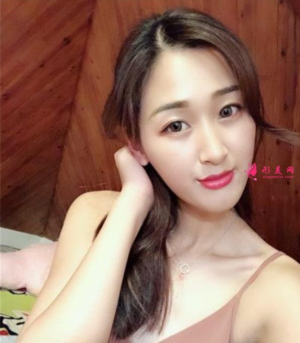 天津医院鼻综合怎么样?鼻翼缩小手术适合人群及价格分享