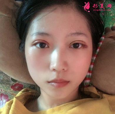 武汉金国华双眼皮怎么样?个人资料技术科普_再看专家案例和收费区间表