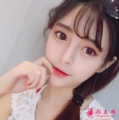 台州恩泽医院整形科隆鼻怎么样?2021价格价目表+案例恢复日记分享