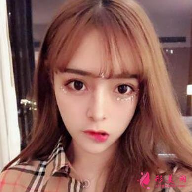 台州恩泽医院整形科隆鼻怎么样?2021价格价目表+案例恢复日记分享