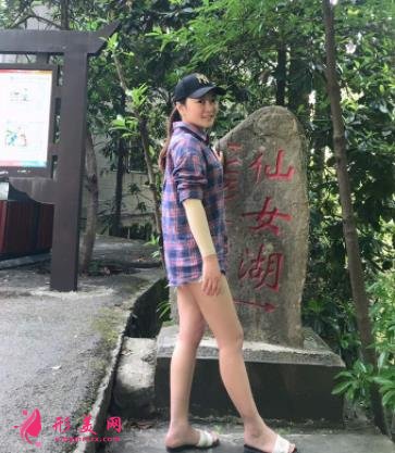 温州医科大学附属第二医院整形科吸脂怎么样?价格及案例分享