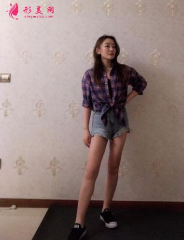 温州医科大学附属第二医院整形科吸脂怎么样?价格及案例分享