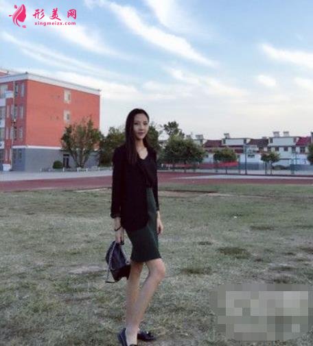 第四军医大学西京医院整形科吸脂效果咋样?案例价格收费表一览