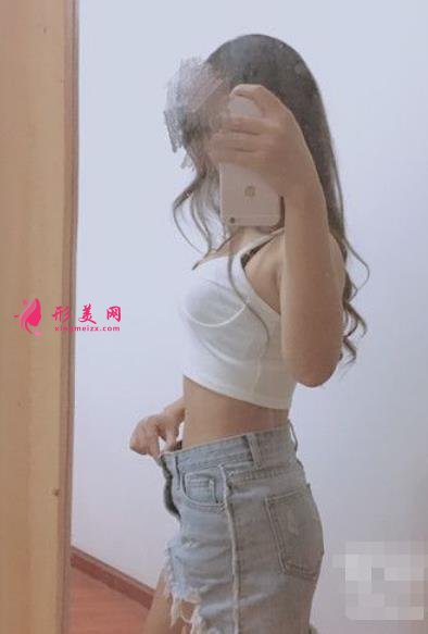 华西医院整形科吸脂案例术后反馈！价格收费标准全新出炉~