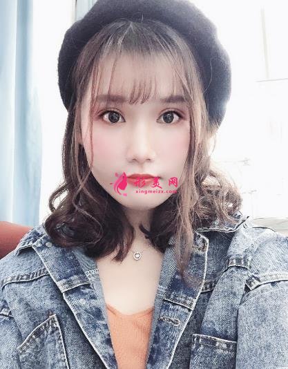 中日友好医院整形科双眼皮怎么样?开眼角留疤了怎么办?