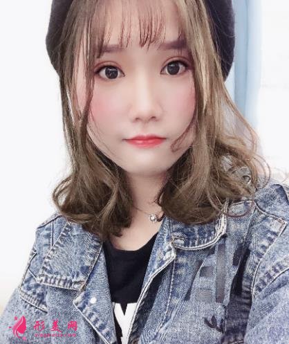 中日友好医院整形科双眼皮怎么样?开眼角留疤了怎么办?