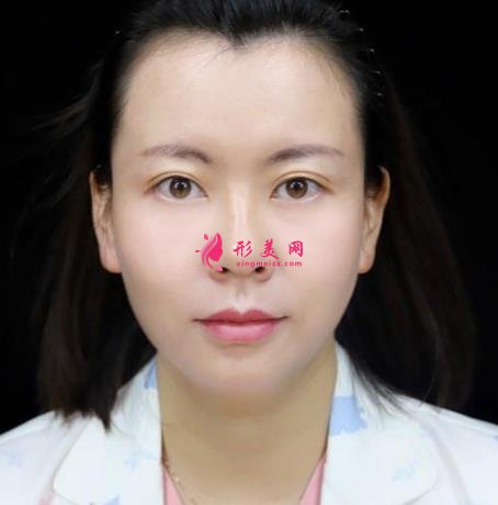 浙医二院整形科做热玛吉怎么样?专家案例、价格表清单一一尽显!