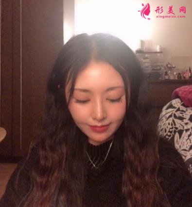 成都新丽美整形医院隆鼻怎么样?口碑案例和正规费用(价格表)一览