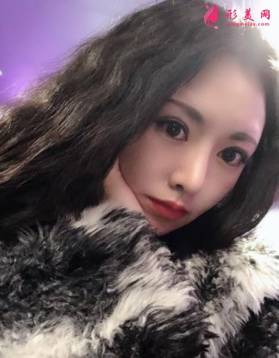 成都新丽美整形医院隆鼻怎么样?口碑案例和正规费用(价格表)一览