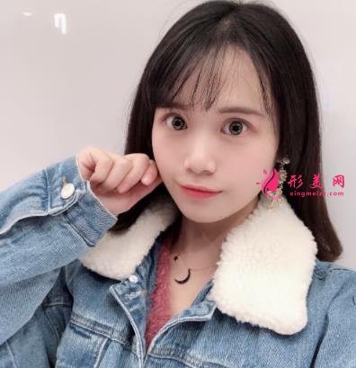 洛阳三院美容科做双眼皮怎么样?真实案例恢复图及价目价格全面了解