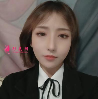 广州美恩整形医院靠谱吗?隆鼻口碑测评一览~含价格费用清单