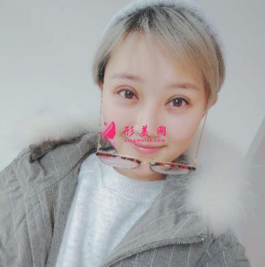 成都润美玉之光整形怎么样?自体脂肪全脸填充案例和真实价格价目分享