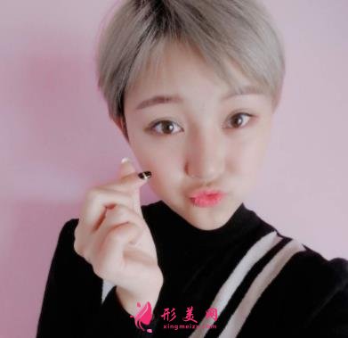 成都润美玉之光整形怎么样?自体脂肪全脸填充案例和真实价格价目分享