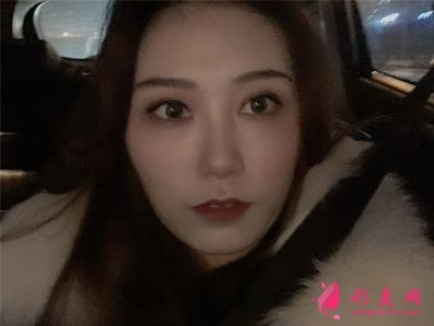 郑东美眼医疗美容怎么样?双眼皮案例效果反馈图及价格费用清单查询