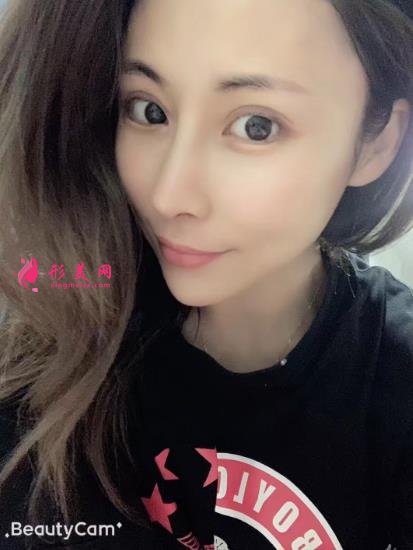 上海伯思立沈国雄鼻修复怎么样?专家案例和价格表参考如下!